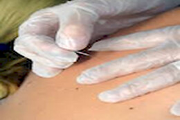 CLÍNICA DE FISIOTERAPIA BRETONES FERNÁNDEZ